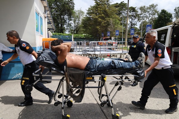 Trabajador resulta con quemaduras en el 80 % de su cuerpo | Nuestro ...